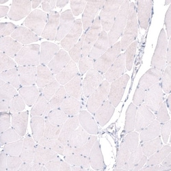 PTPRK Antibody, Novus Biologicals:Antibodies:Primary Antibodies